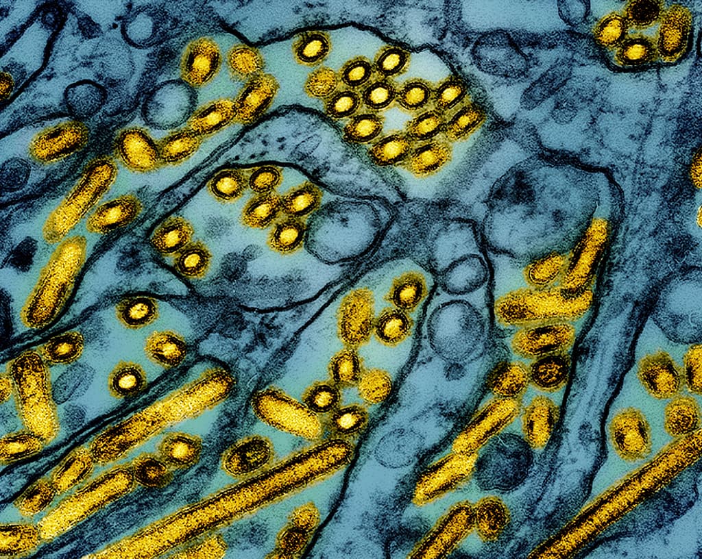 New study suggests bird flu is undercounted in the US