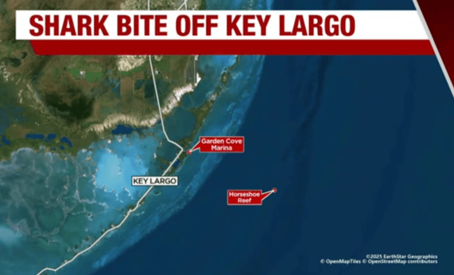 8-year-old boy bitten by shark off Florida Keys