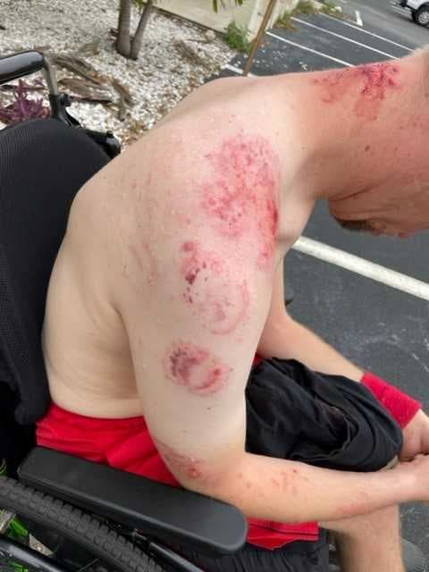 Marco Island family sues para-transit company after disabled son’s alleged assault on bus