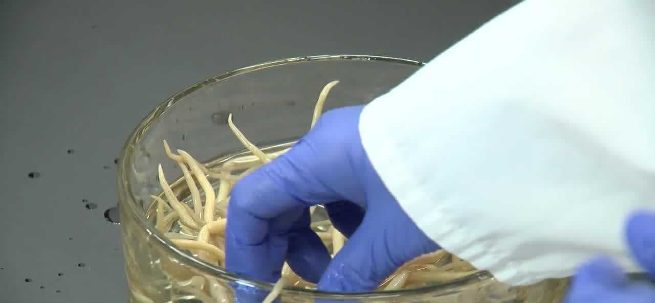 Experts debunk viral parasite claims and warn against unnecessary deworming
