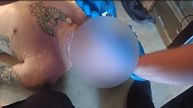 Watch: Bodycam footage shows Lee County deputy rescuing man after overdose