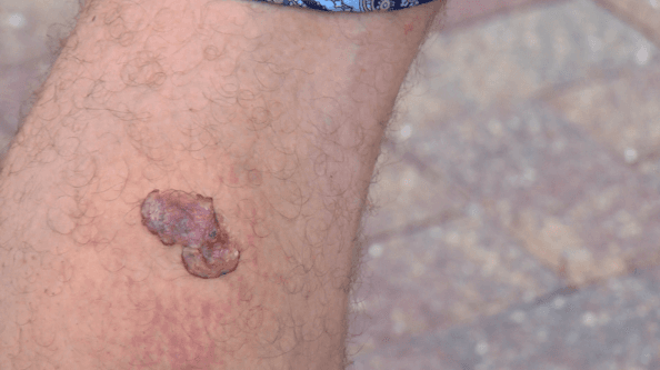 ‘It could’ve killed me’: Seagate Beach party turns violent with gunfire